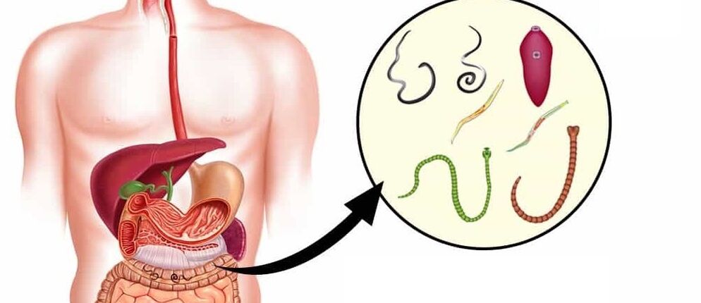 Παράσιτα στο ανθρώπινο σώμα
