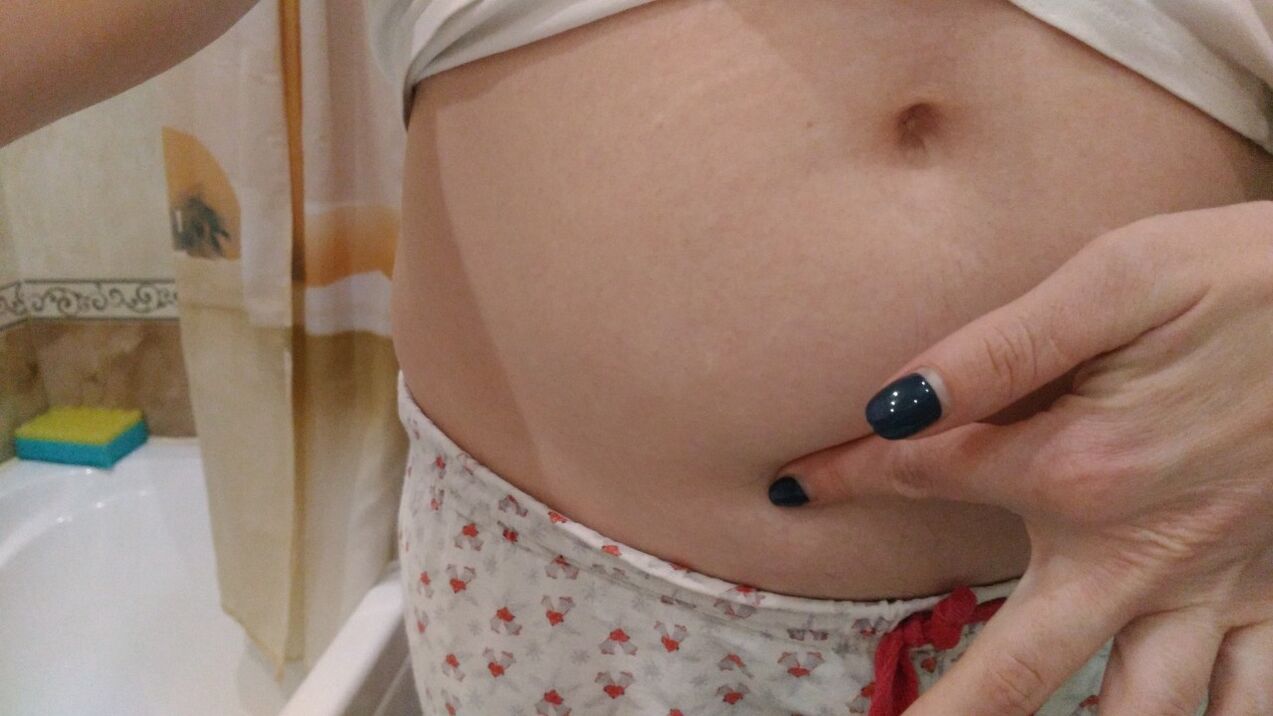 Σημάδια ελμινθικής λοίμωξης από προσωπική εμπειρία