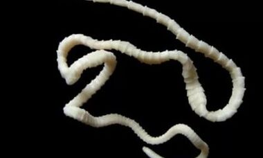 πώς να αφαιρέσετε το παράσιτο των κεστωδών από το σώμα