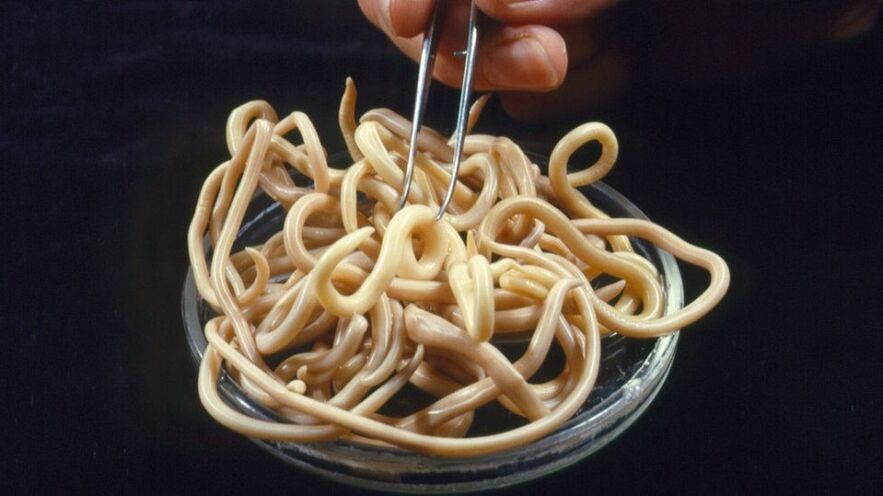 παράσιτα από το ανθρώπινο σώμα